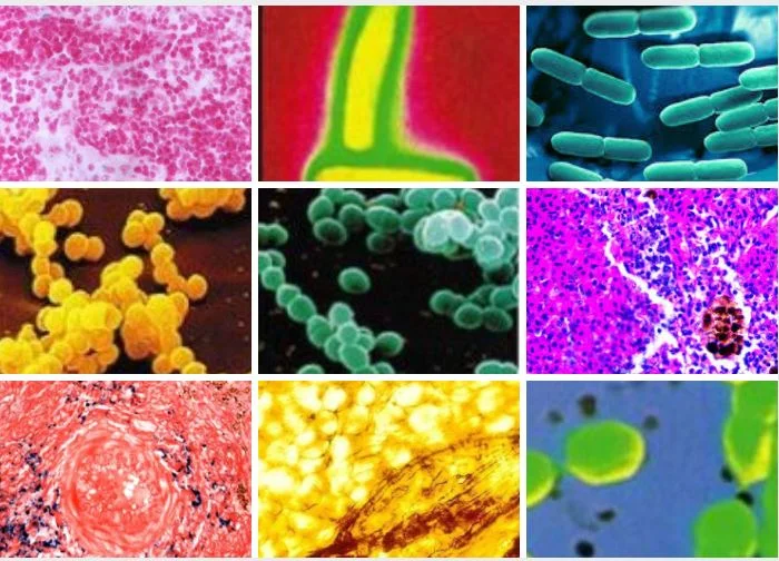 Les pesticides et la maladie de Parkinson 