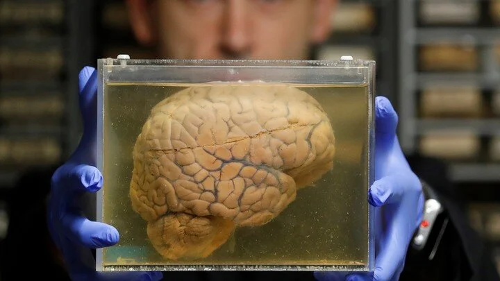 Einstein's Brain