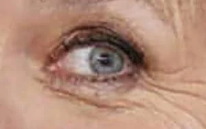 oeil.jpg