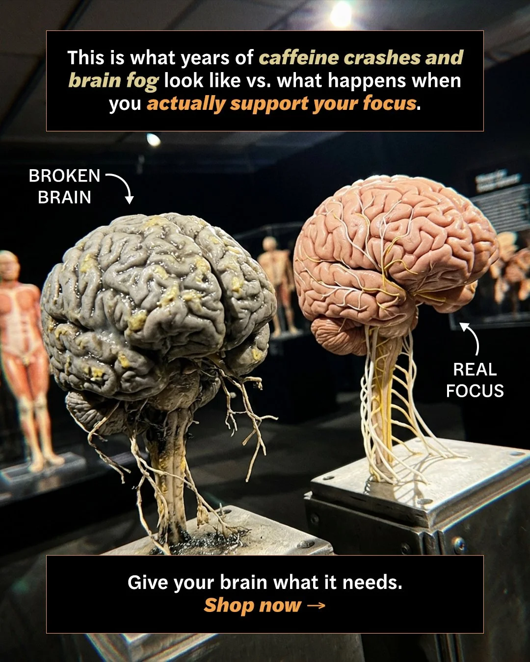 20260519_BR_206_Elevate_Anatomy_4x5_v6b.jpg