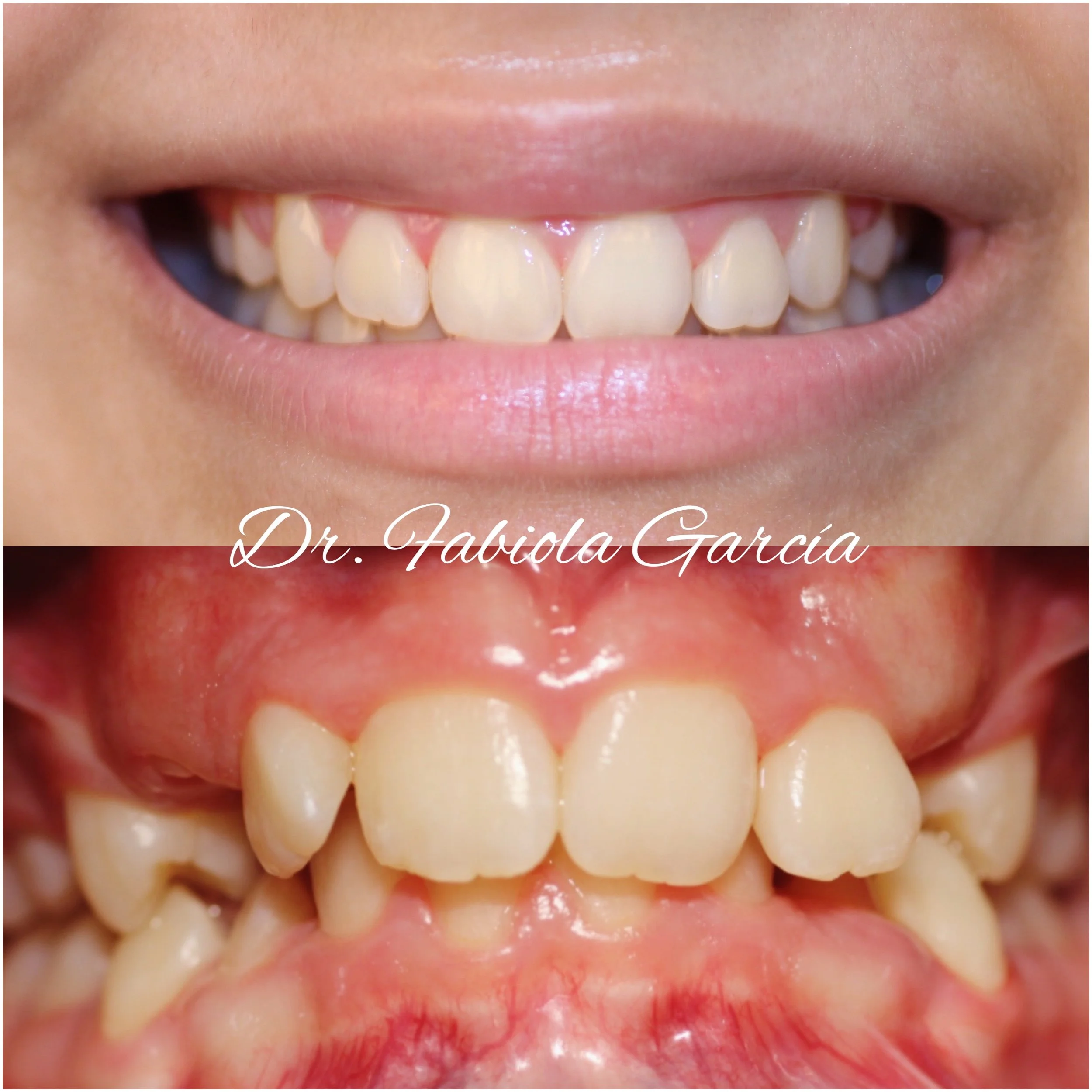 Dentist Houston TX Cosmetic & Family Dental Fabulous Dentistry