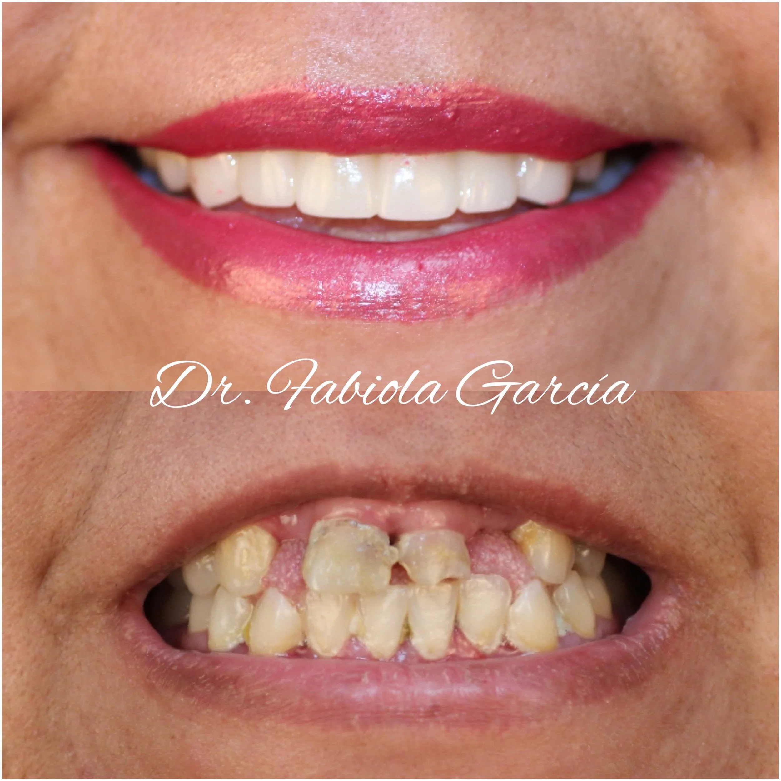 Dentist Houston TX Cosmetic & Family Dental Fabulous Dentistry