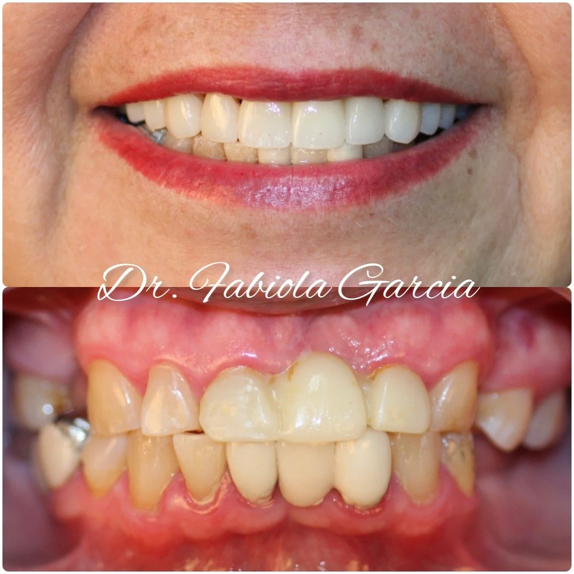 Dentist Houston TX Cosmetic & Family Dental Fabulous Dentistry