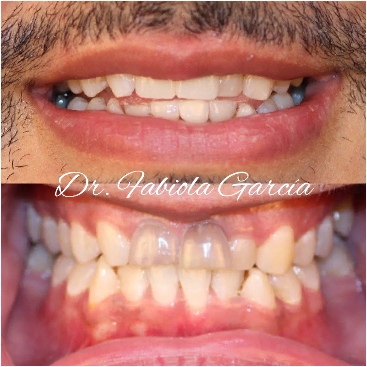 Dentist Houston TX Cosmetic & Family Dental Fabulous Dentistry