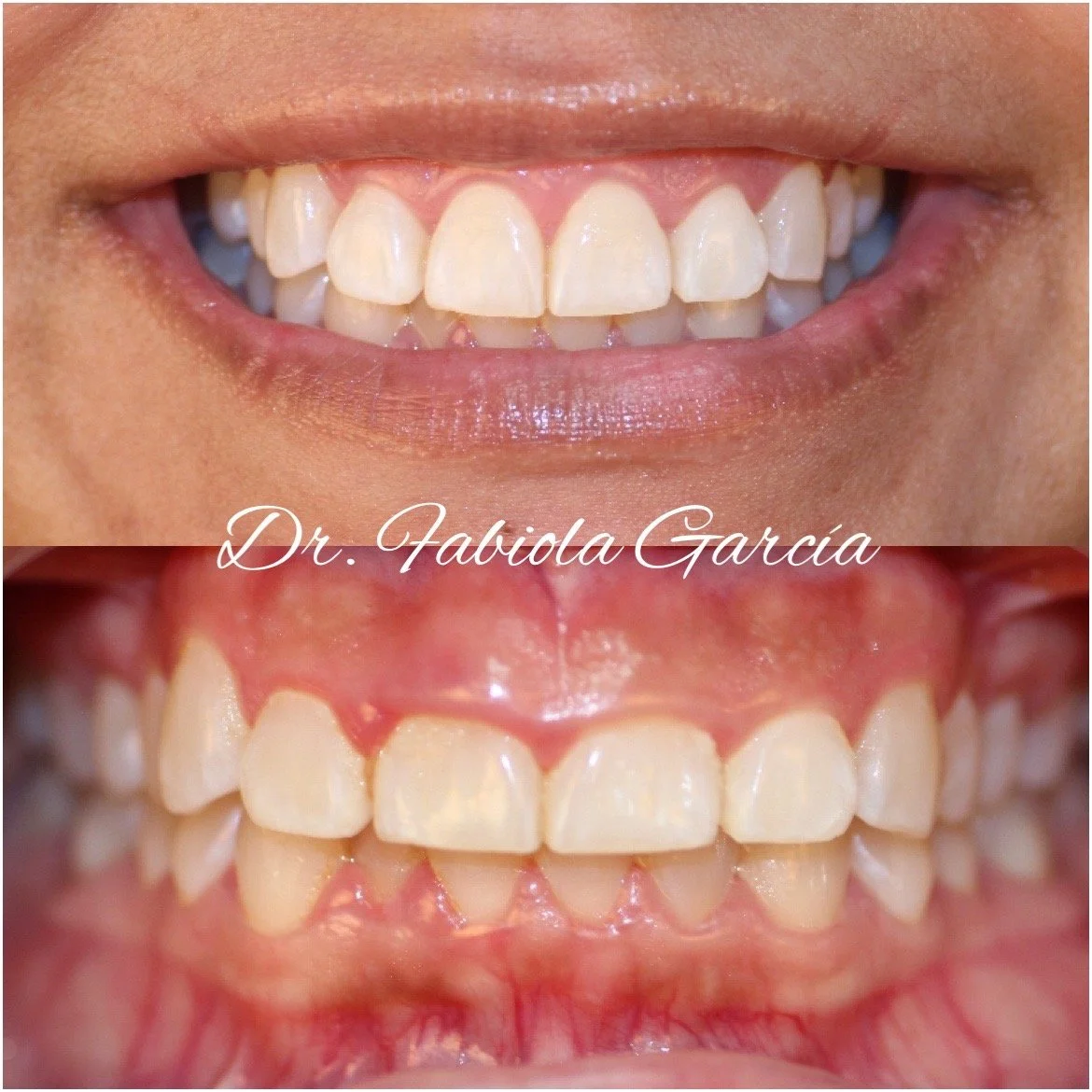 Dentist Houston TX Cosmetic & Family Dental Fabulous Dentistry