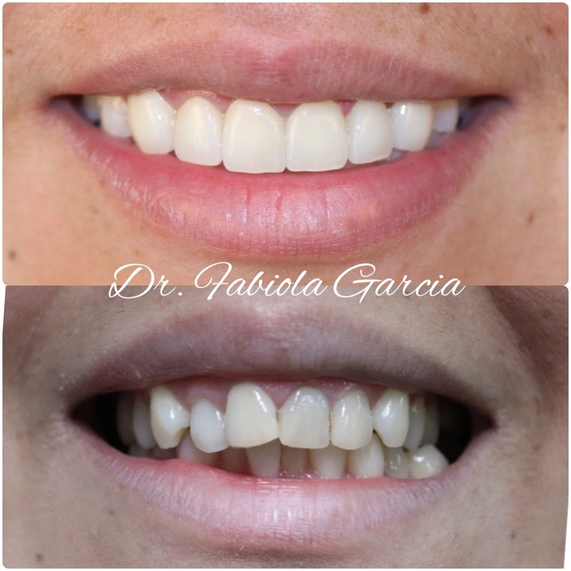 Dentist Houston TX Cosmetic & Family Dental Fabulous Dentistry