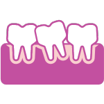 Crooked teeth
