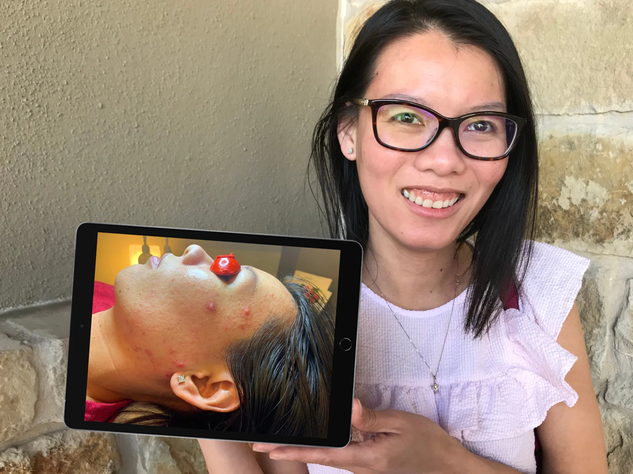 acne treatment personalized