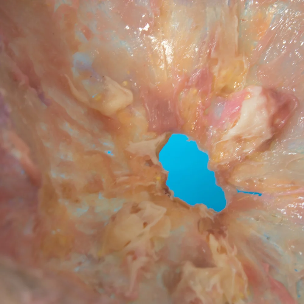   Gutbucket , detail 