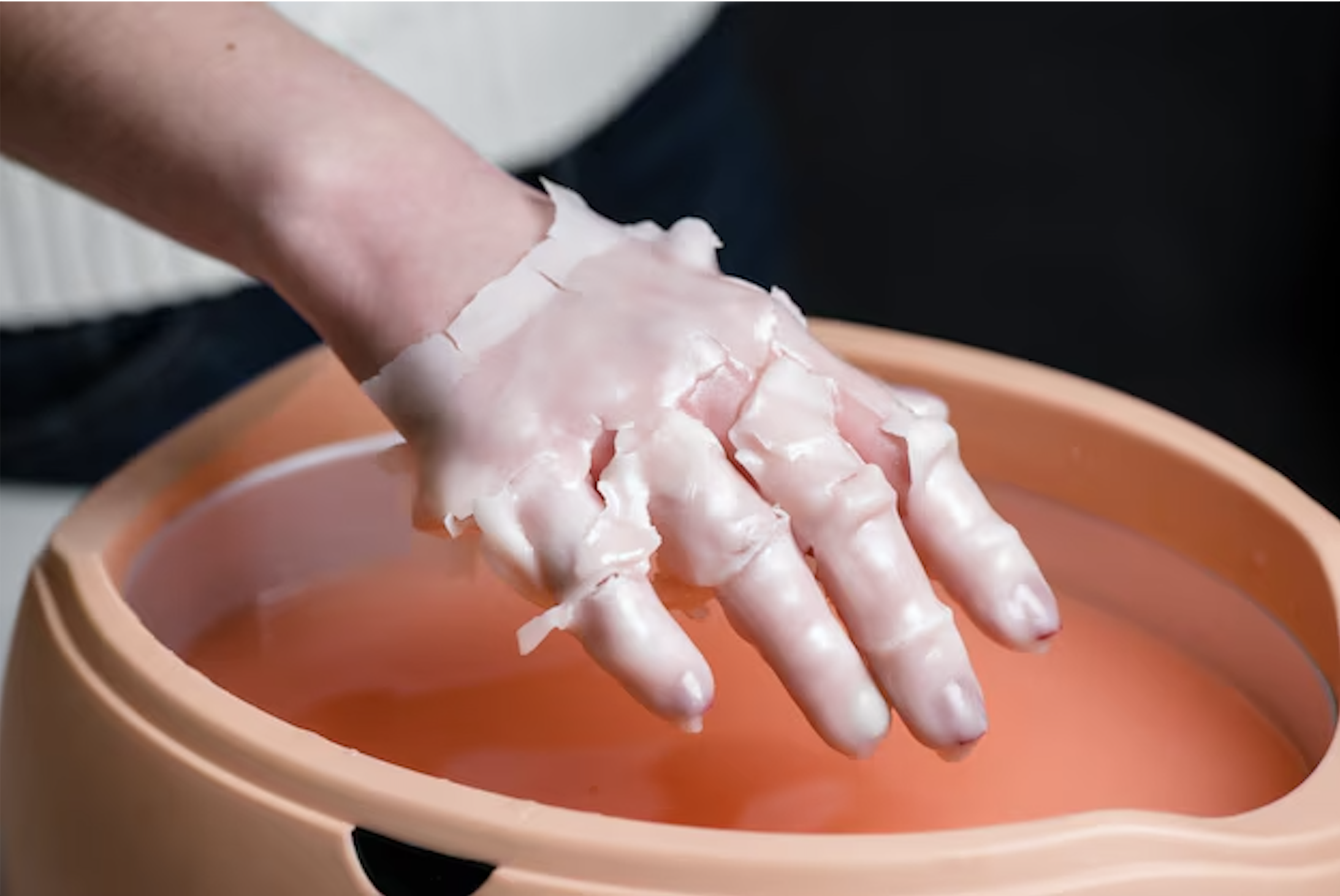 Treatment paraffin.png