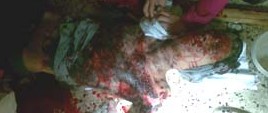 Ami-Bomb-Blast-Images.-Israel-Hate-Crime-e1317442075665.jpg