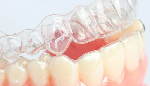 Do You Grind Your Teeth?