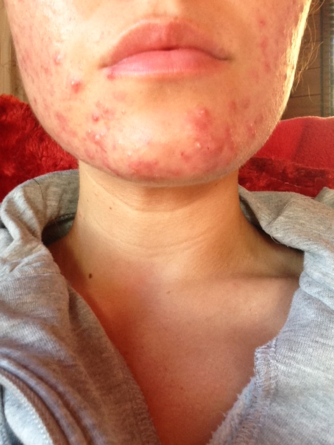 Capture.PNG