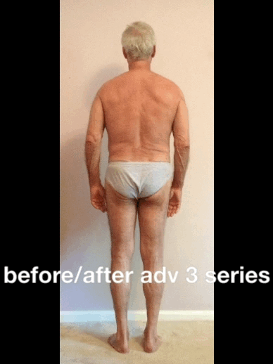 Joe before:after adv3 2015.gif