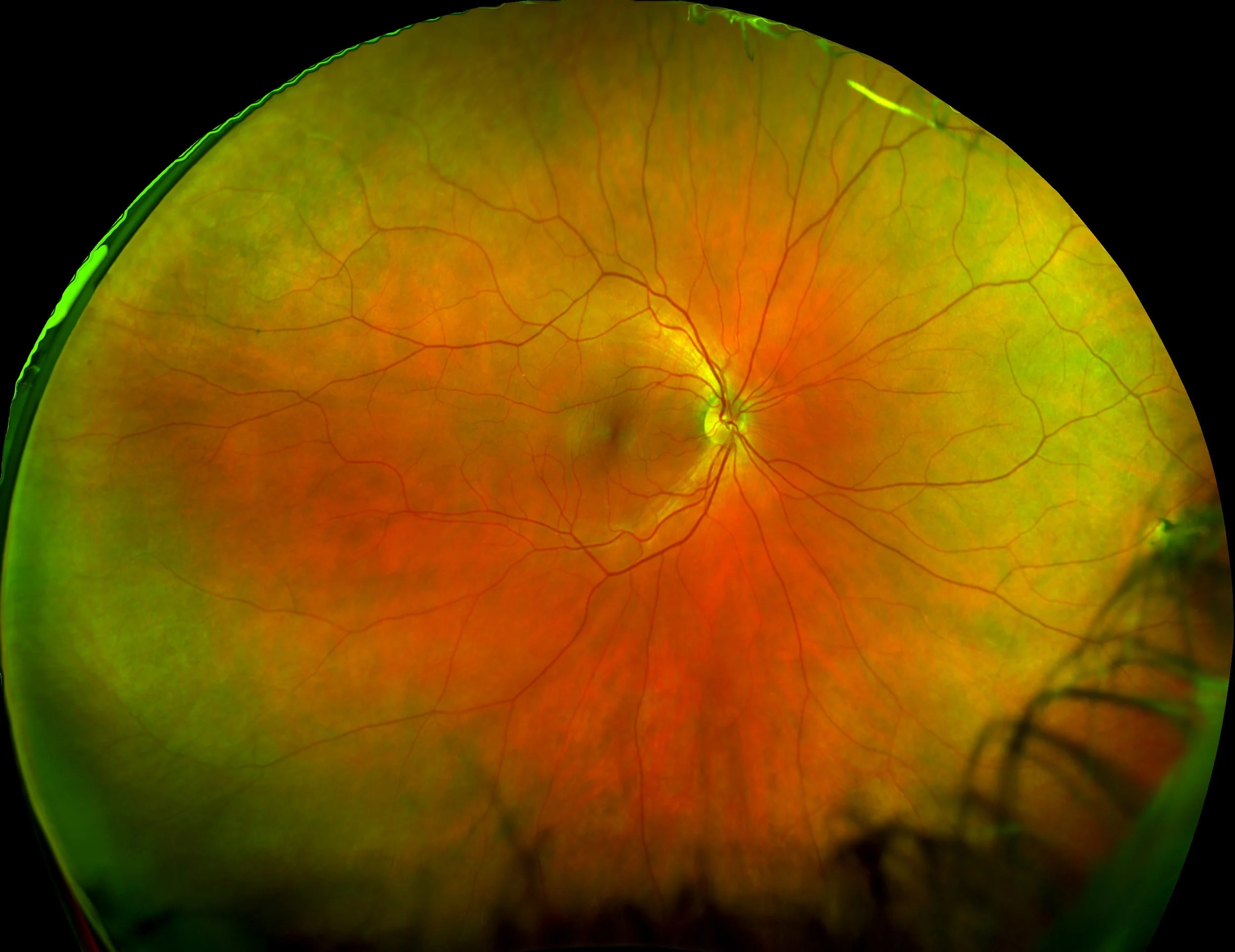 retinalmapping.jpg