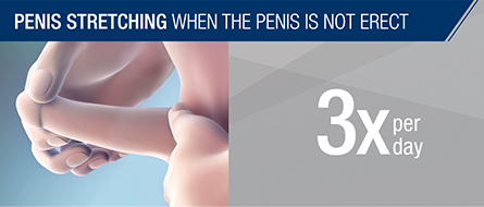 pdpat_pages_how_xiaflex_penis_stretching.png