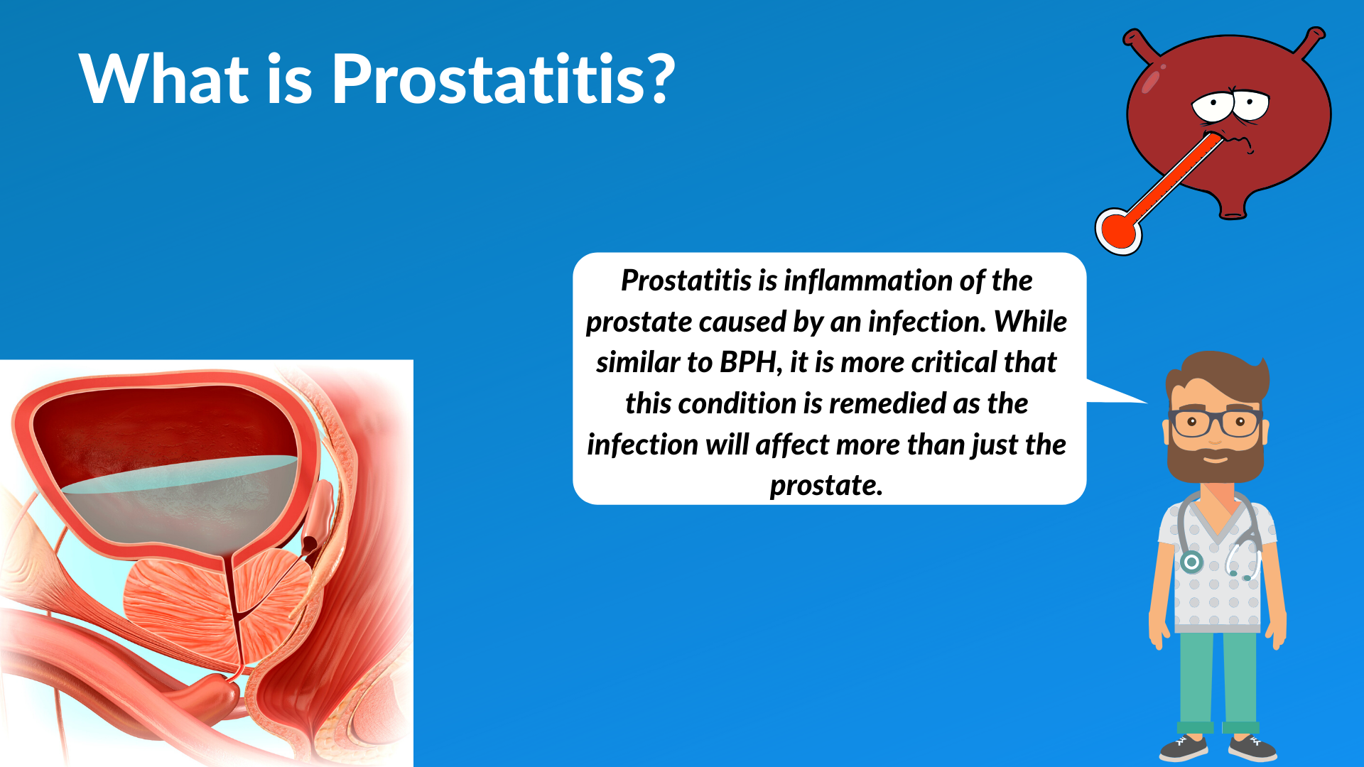 Vesicar a prostatitis alatt
