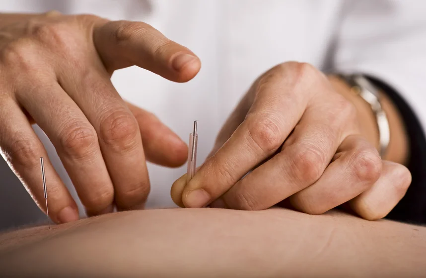 Tapping in Needles.jpg