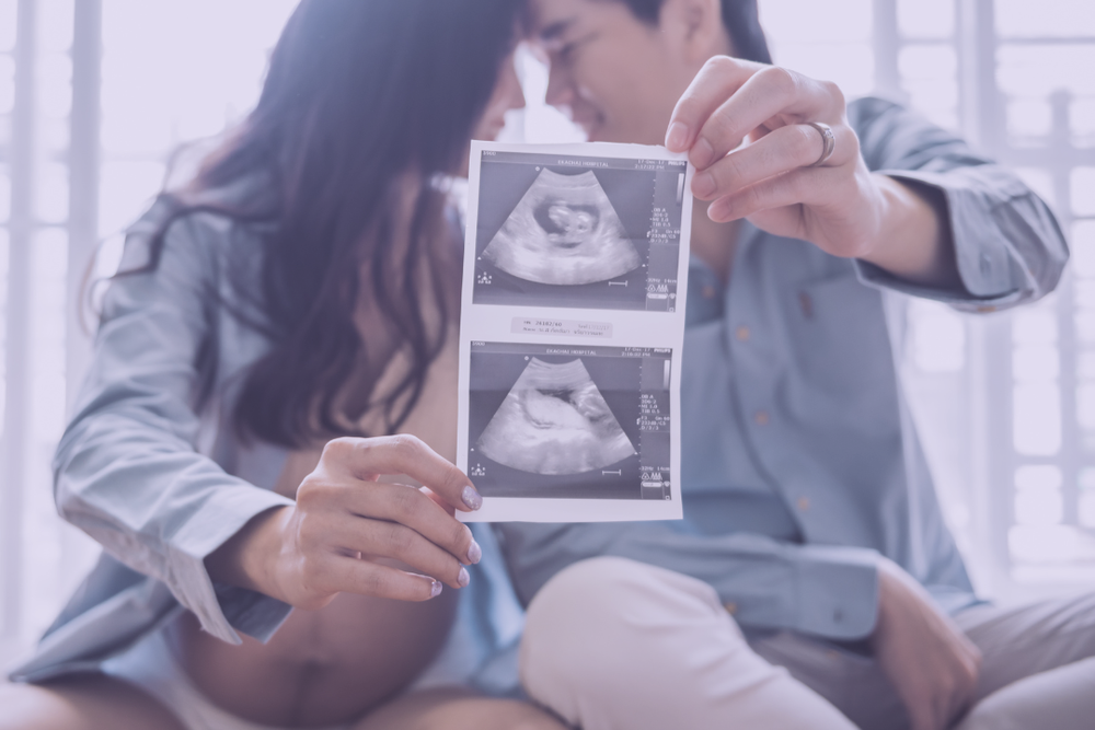 When Can You Find Out Your Baby's Sex — Wellington Obstetrics