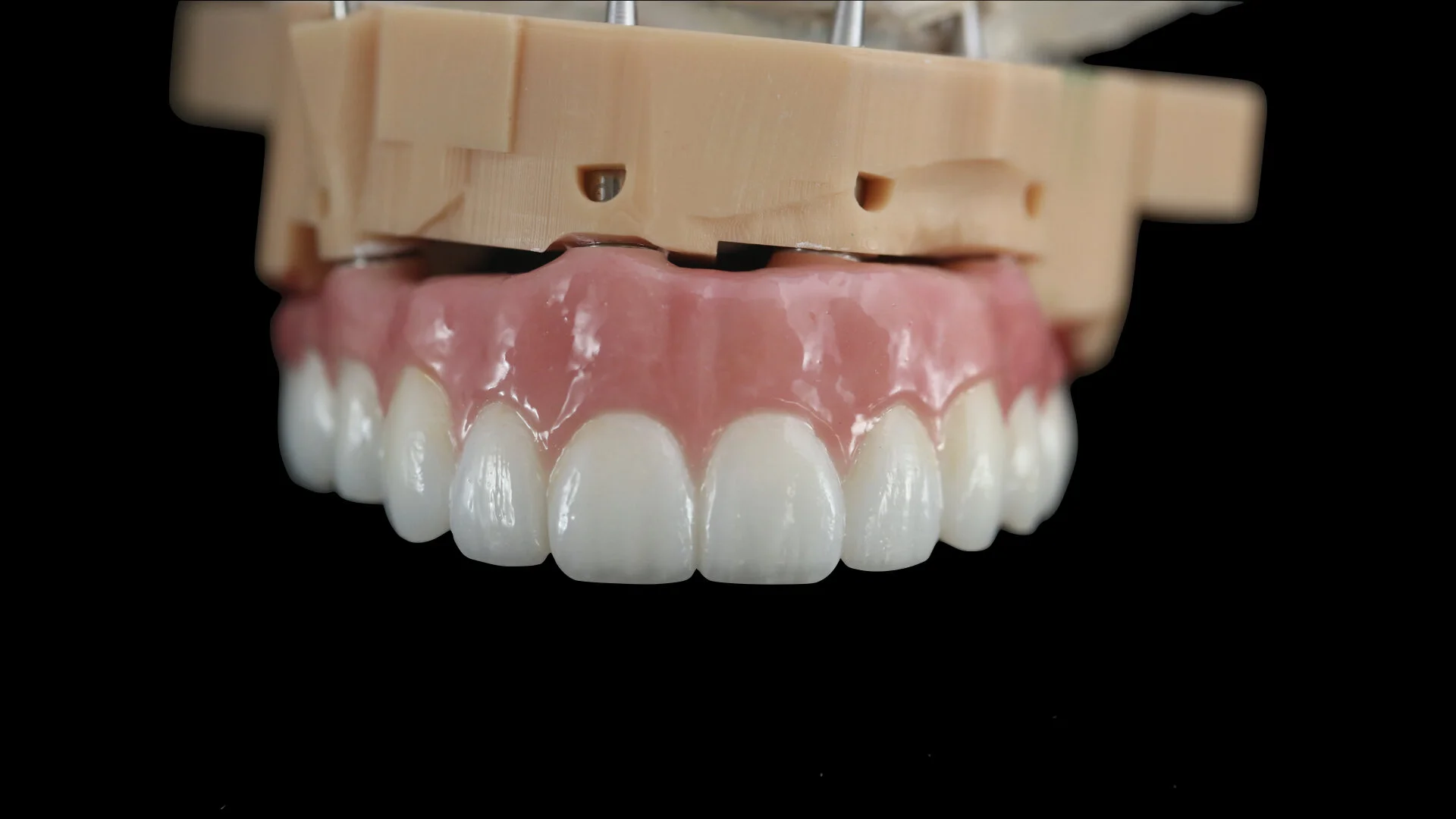 Services — Ceramics West Dental Lab