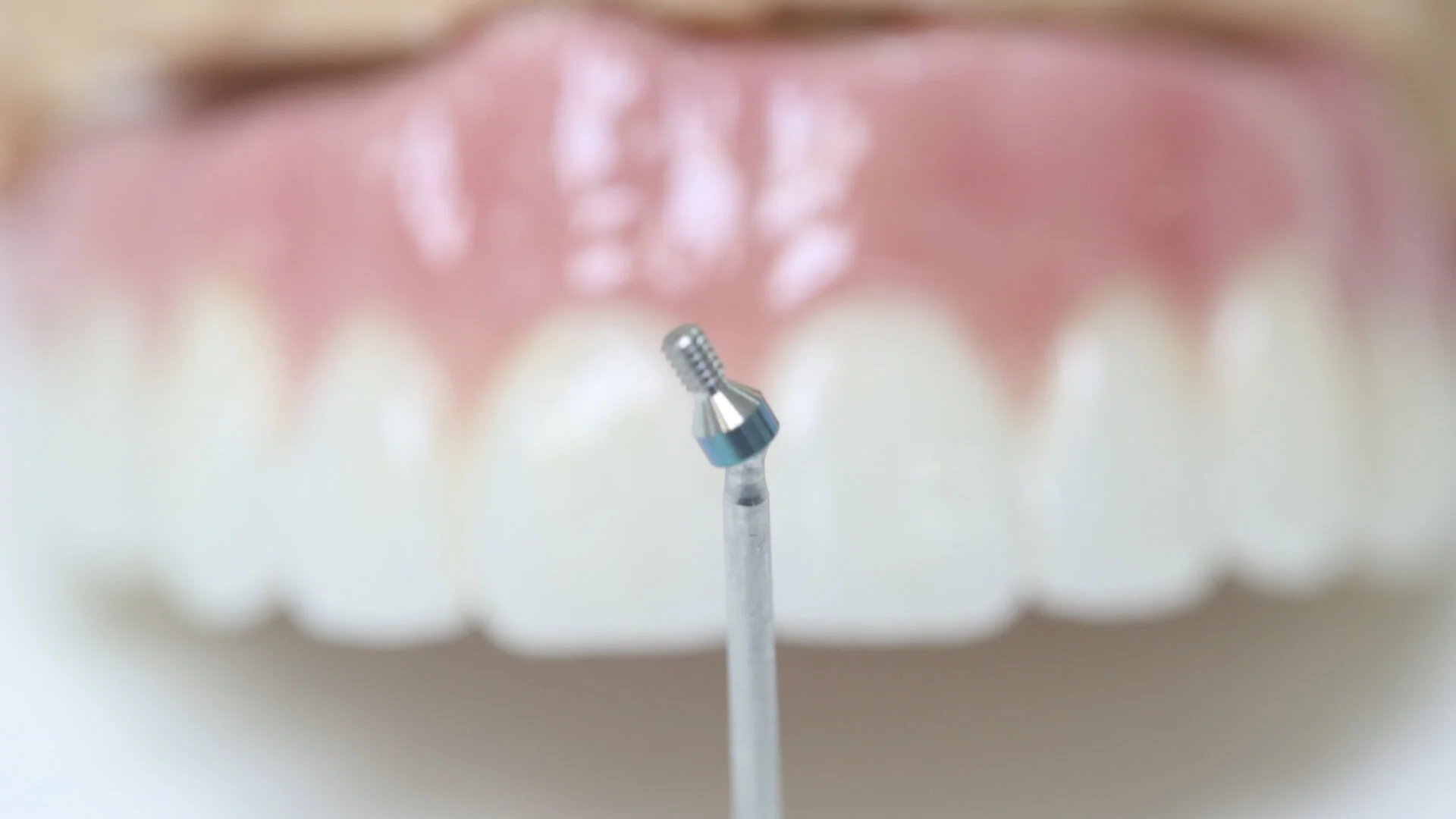 Services — Ceramics West Dental Lab