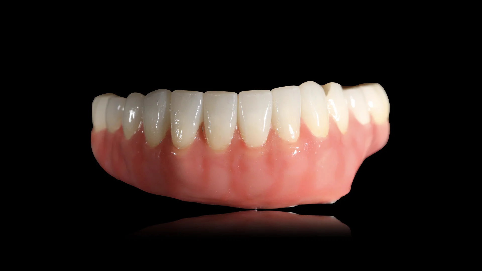 Services — Ceramics West Dental Lab