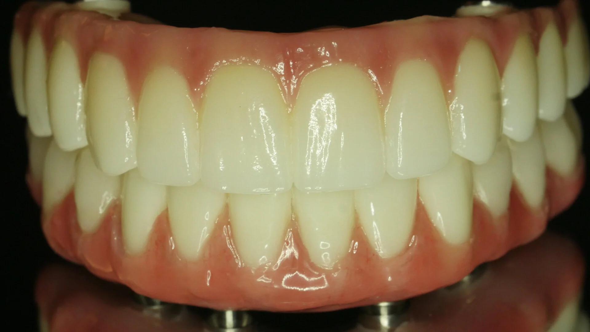 Services — Ceramics West Dental Lab