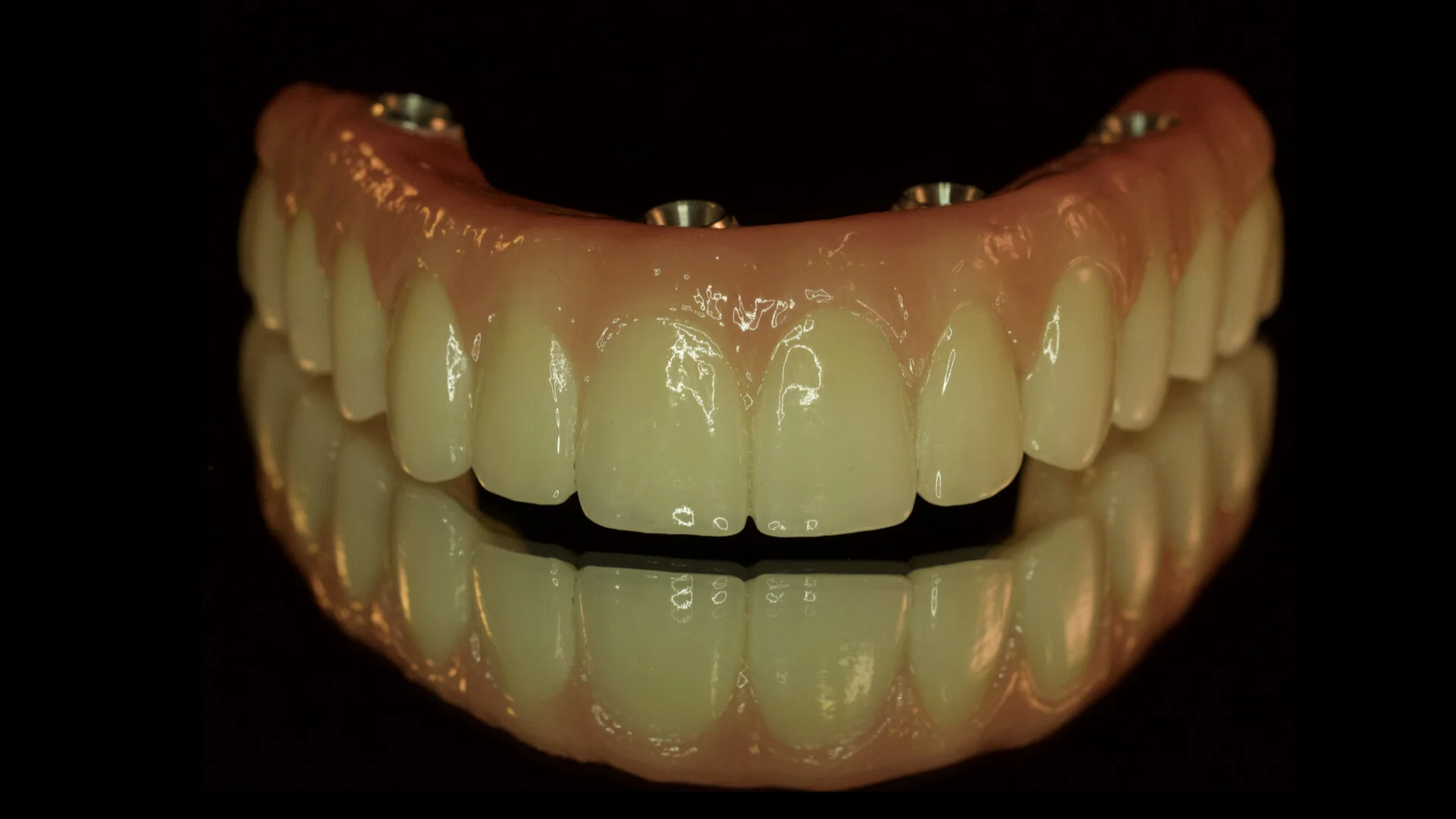 Services — Ceramics West Dental Lab