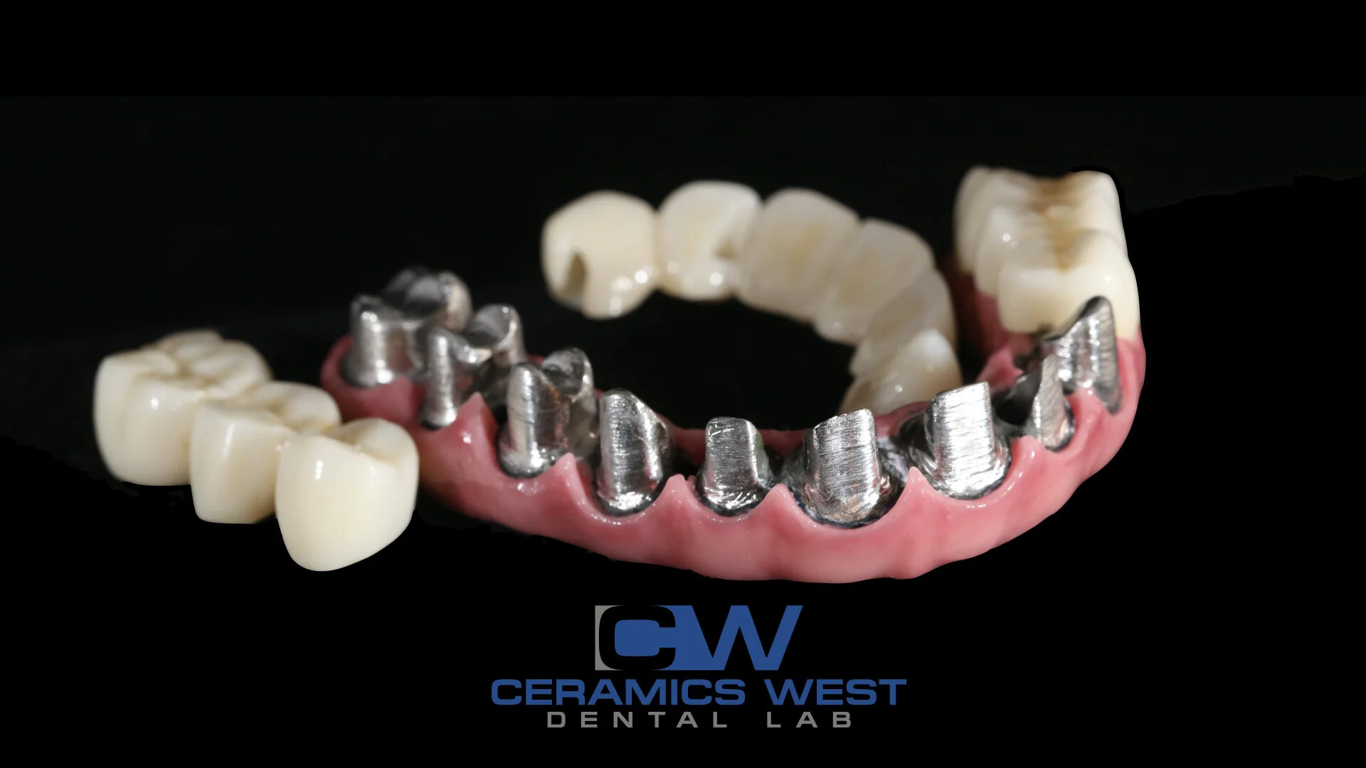 Services — Ceramics West Dental Lab