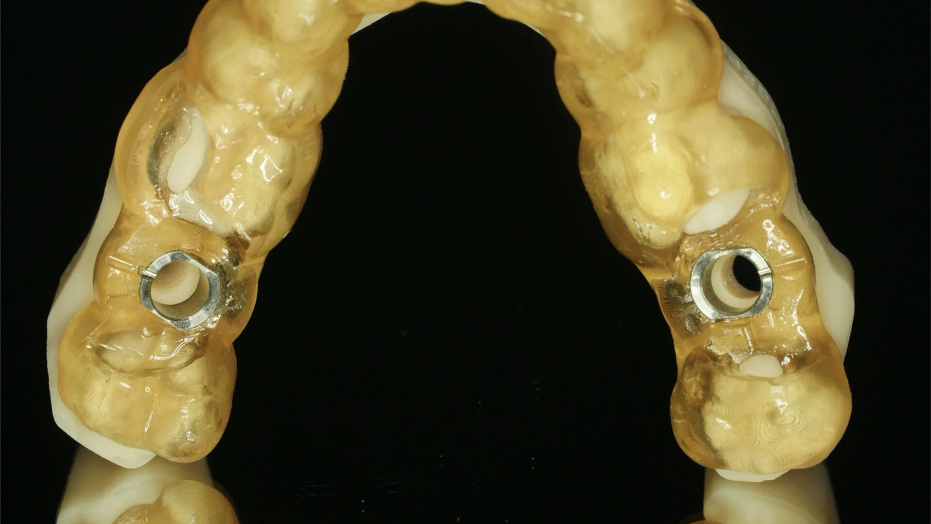 Services — Ceramics West Dental Lab