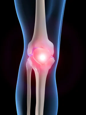 iStock_000003568886XSmall.jpg