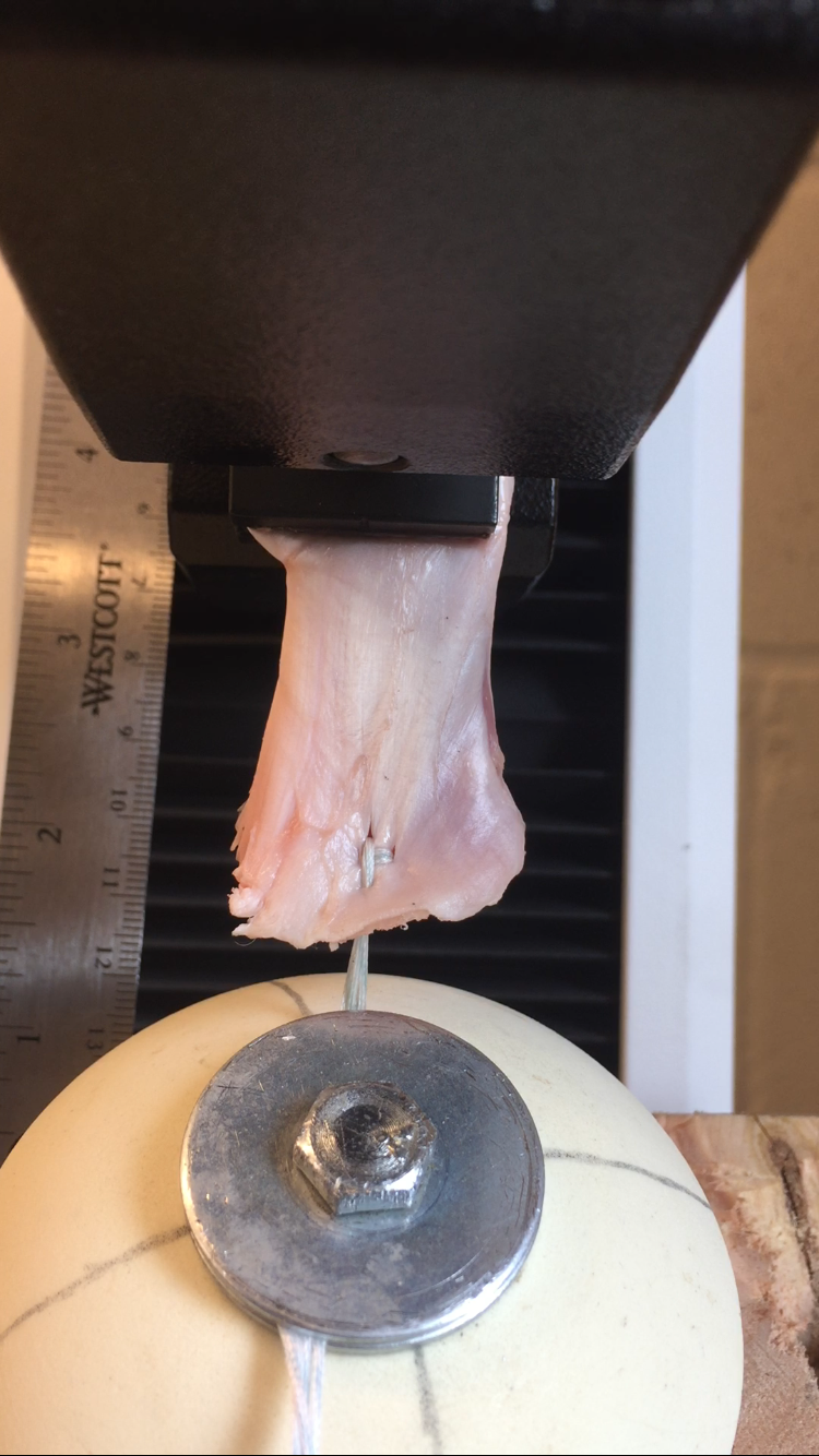 Soft Tissue Dynamics