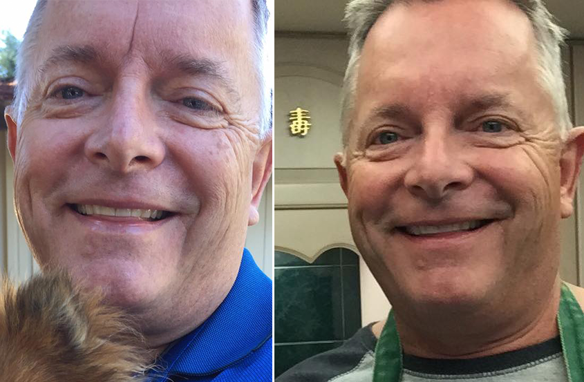 before after.png