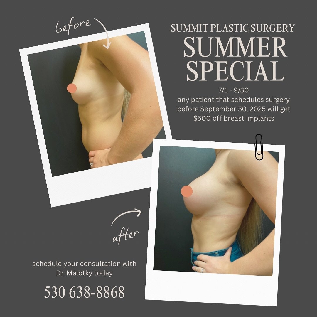 Our Summer Special has dropped and it&rsquo;s one you do not want to miss ⬇️

From 7/1 - 9/30 any patient that signs up for surgery before September 30, 2025 will get $500 off breast implants! 

Call today to set up a consultation with #boardcertifie
