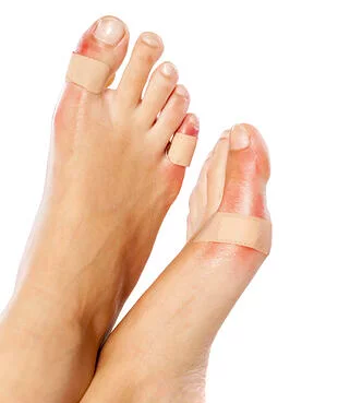 FOOT HEALTH ISSUES EXPLAINED: BLISTERS, PLANTAR FASCIITIS & BUNIONS — River  Podiatry I The Best Foot and Ankle Care in NY/NJ