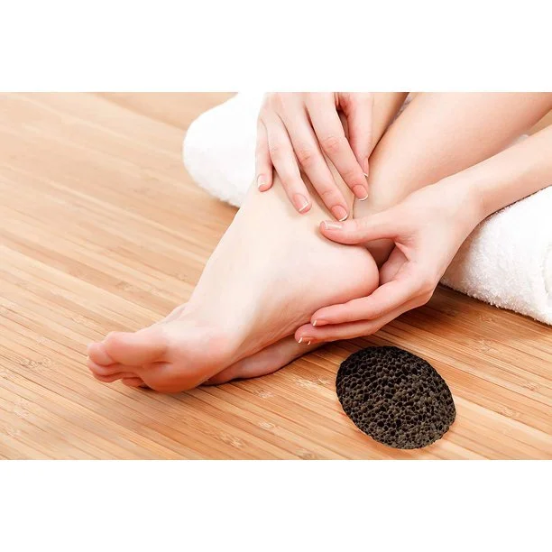 Tips to address rough skin and calluses