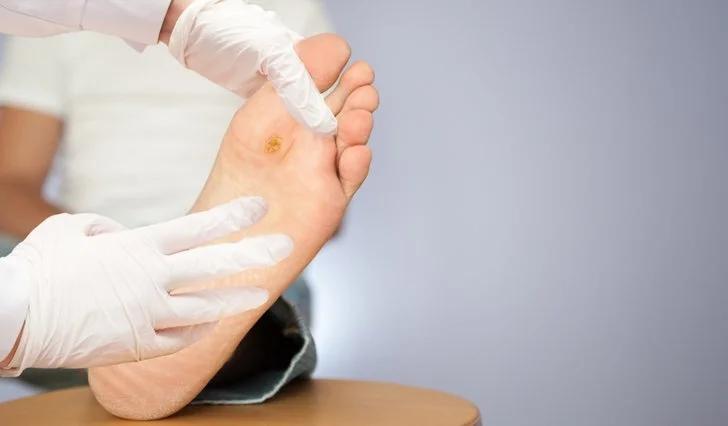 Why Professional Care for Diabetic Wounds Is Crucial 