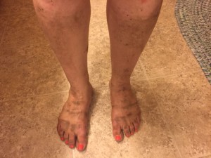 dirty feet