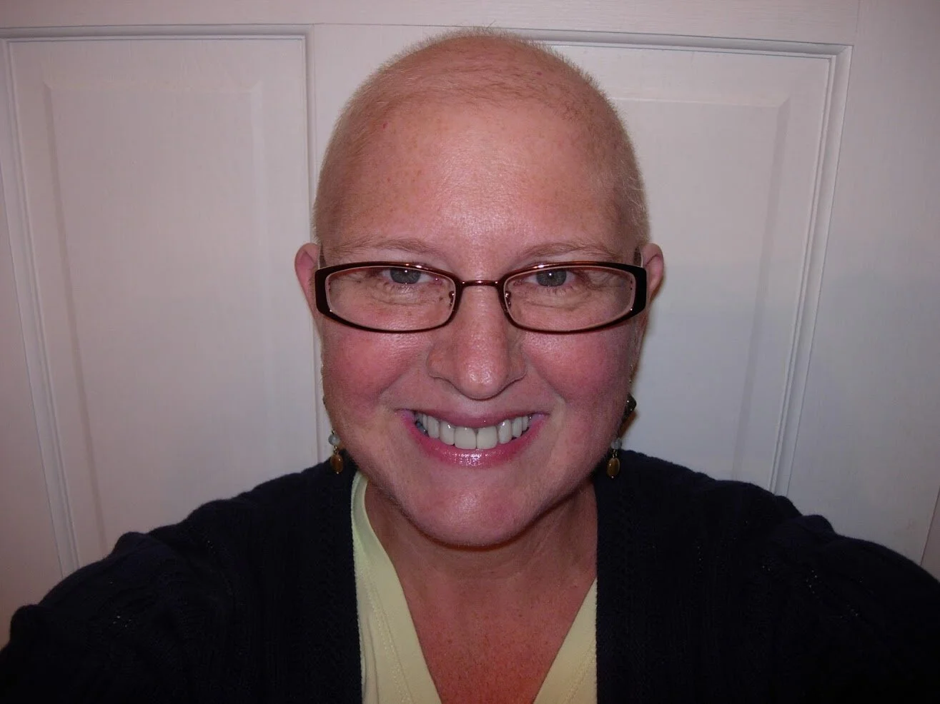 Reflections about Being Bald