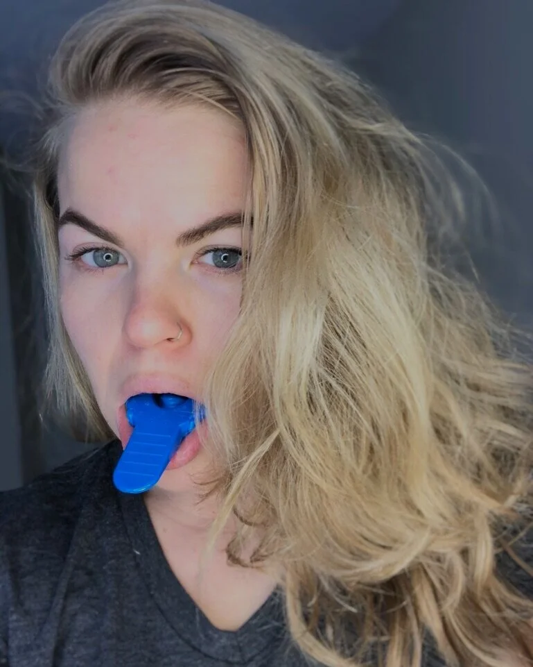 My First Teeth Whitening Experience: Smile Brilliant Results ...