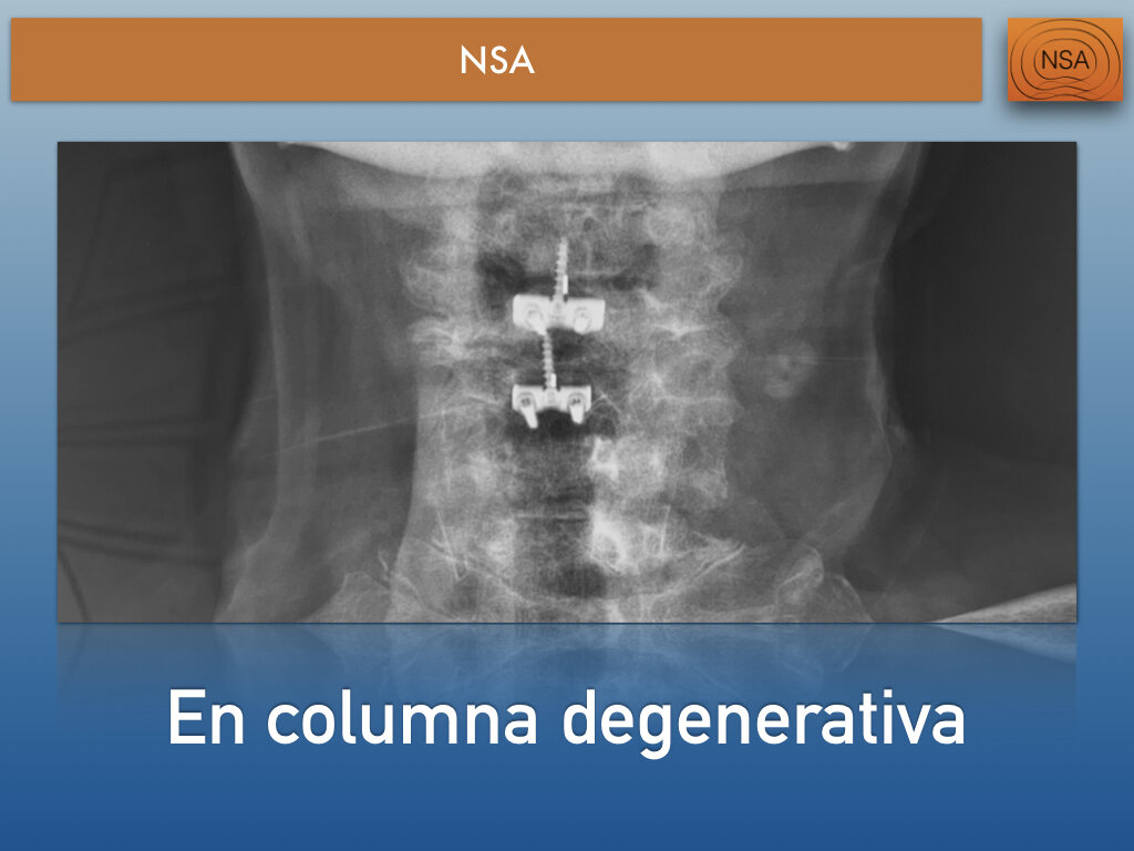 NSA Cajas cervicales con bloqueo.011.jpeg