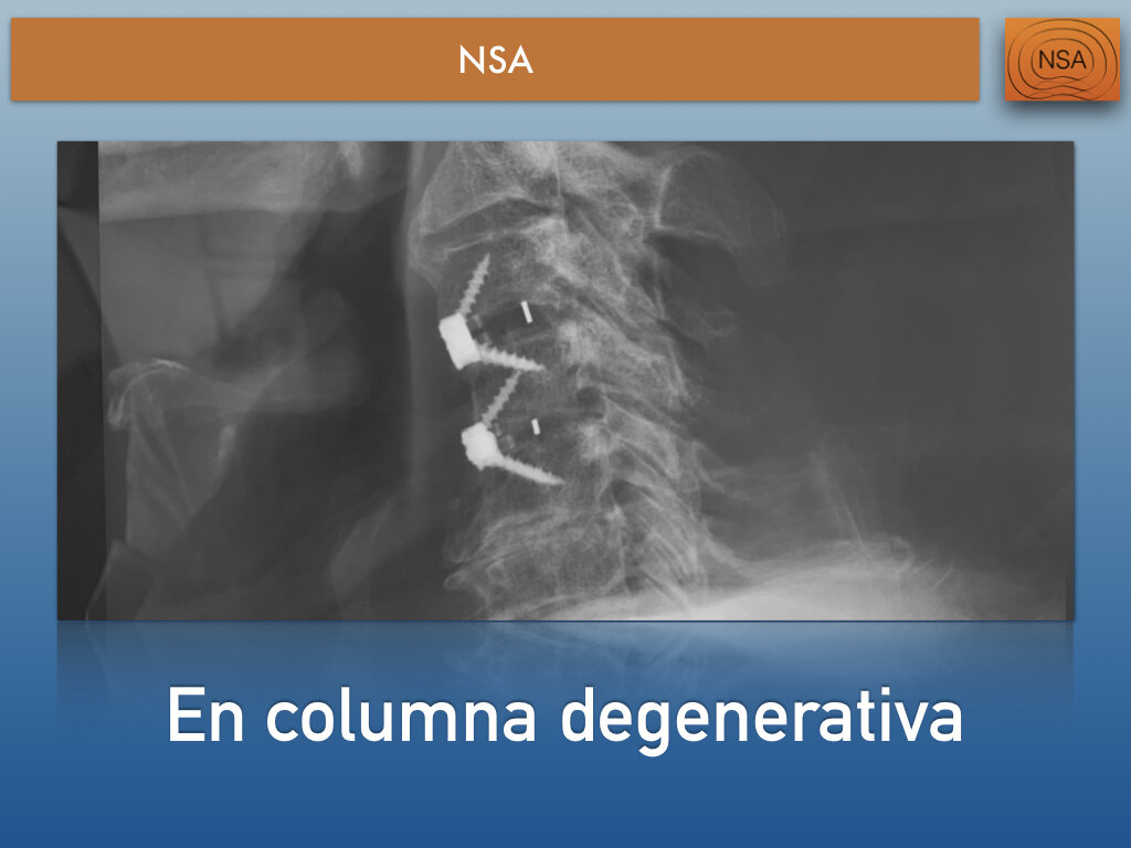 NSA Cajas cervicales con bloqueo.012.jpeg
