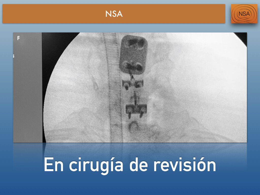NSA Cajas cervicales con bloqueo.013.jpeg