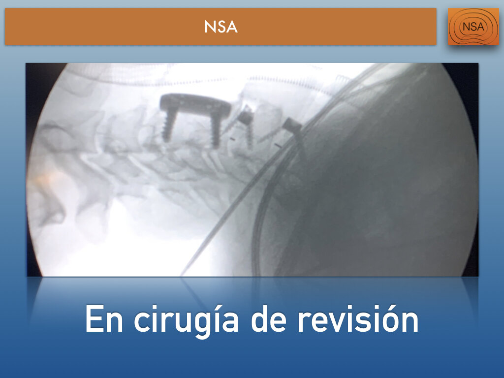 NSA Cajas cervicales con bloqueo.014.jpeg