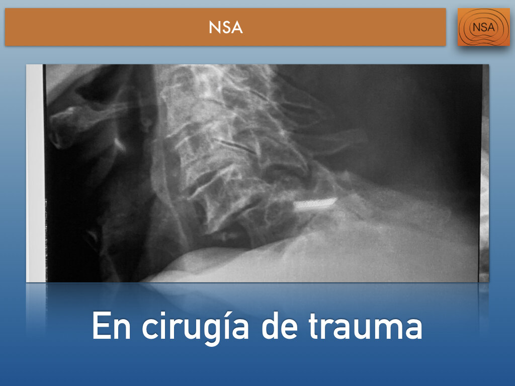 NSA Cajas cervicales con bloqueo.015.jpeg