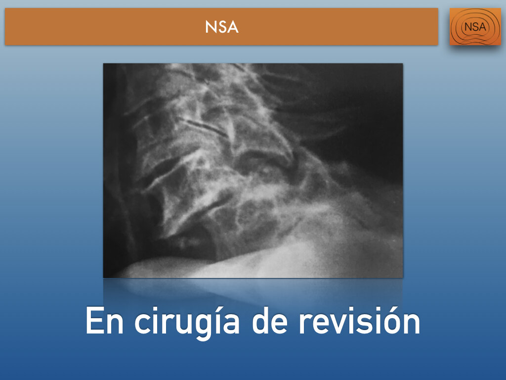 NSA Cajas cervicales con bloqueo.017.jpeg