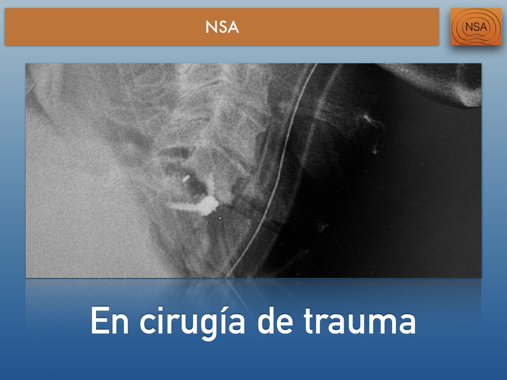 NSA Cajas cervicales con bloqueo.016.jpeg