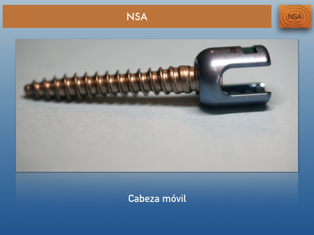 NSA Tornillo transpedicular normal.004.jpeg