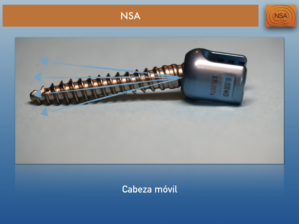NSA Tornillo transpedicular normal.005.jpeg