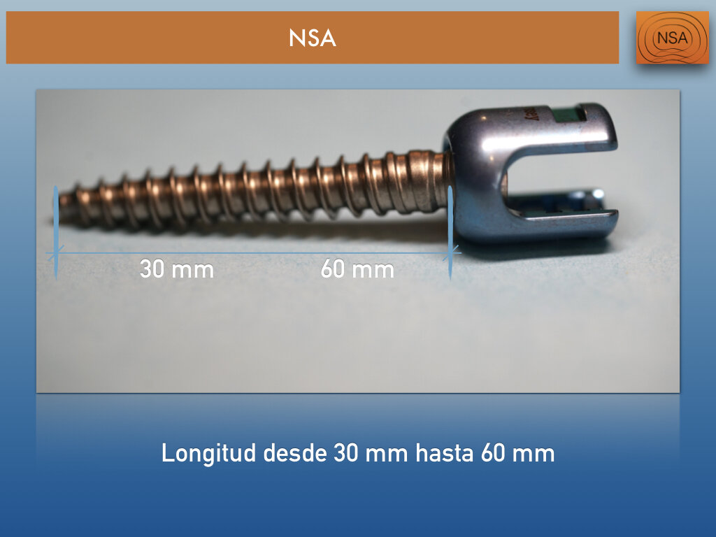 NSA Tornillo transpedicular normal.006.jpeg